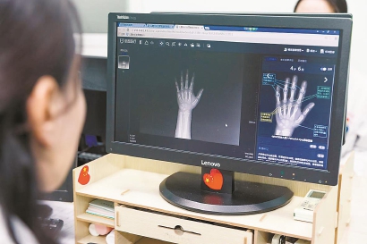 上海新闻丨国内首个儿童医疗服务平台在沪初步建成 社区“人工智能医生”为孩子测骨龄