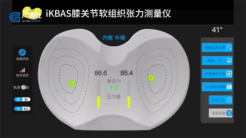 爱乔医疗运用数字化技术助力关节外科手术精准化(图3)