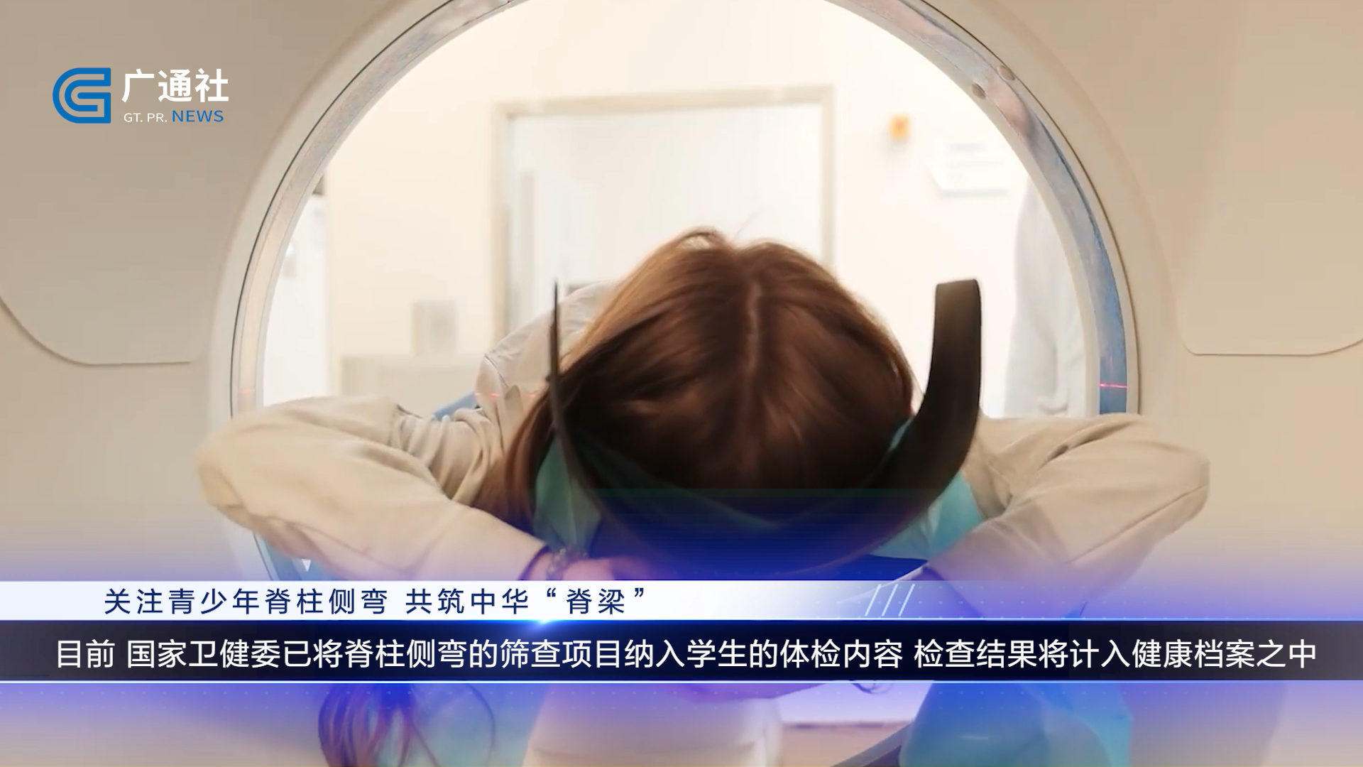 上海强直医院脊柱矫正中心:专注脊柱侧弯防治,守护青少年脊柱健康