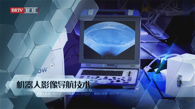 精准、智能、安全，北京智愈医疗水刀手术机器人引领医疗创新(图4)
