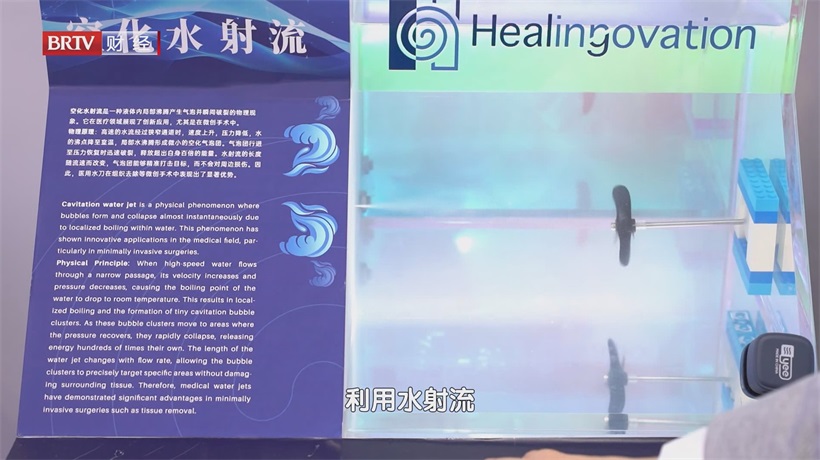精准、智能、安全，北京智愈医疗水刀手术机器人引领医疗创新(图6)