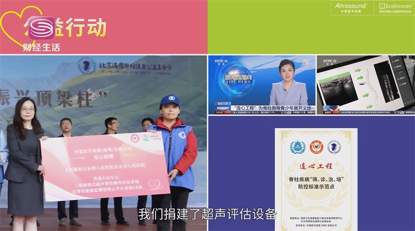 中慧医学成像B超技术革新，推动脊柱侧弯检测迈向精准医疗(图10)