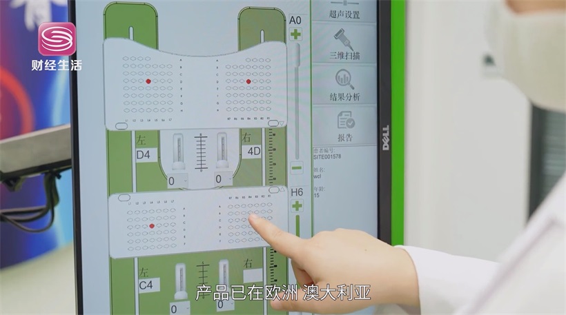 中慧医学成像B超技术革新，推动脊柱侧弯检测迈向精准医疗(图6)