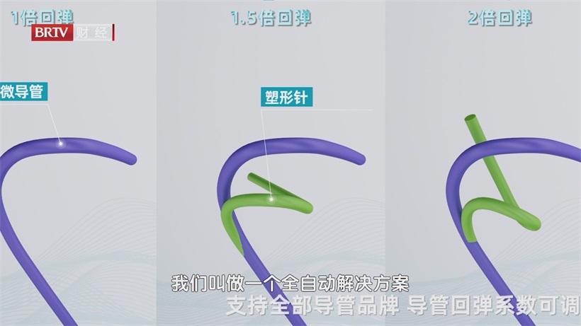 强联智创AI赋能颅内动脉瘤手术，引领医疗科技新飞跃(图7)