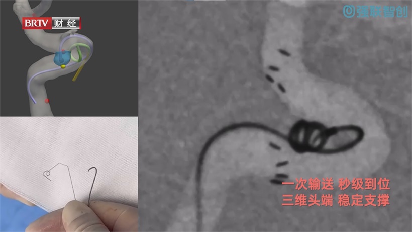 强联智创AI赋能颅内动脉瘤手术，引领医疗科技新飞跃(图9)