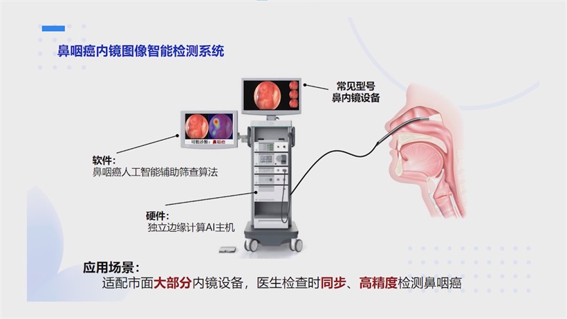 诺美新创携手复旦眼耳鼻喉科医院：鼻咽癌内镜图像AI检测创新成果入围国评(图7)