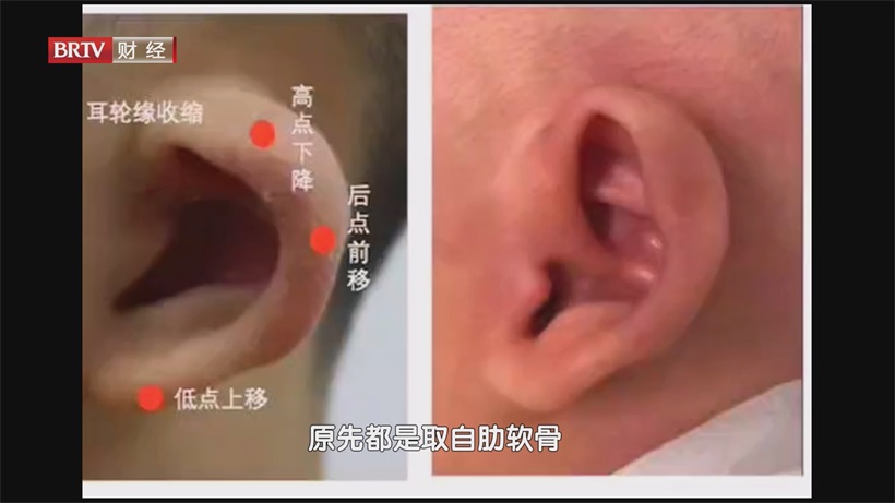 从实验室到临床：八大处整形科技解码科技赋能医疗的“创新密码”(图13)