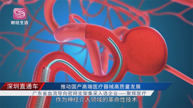 聚辉医疗携创新支架，推动国产高端医疗器械高质量发展(图3)