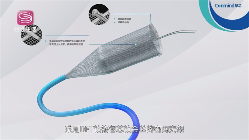 聚辉医疗携创新支架，推动国产高端医疗器械高质量发展(图1)